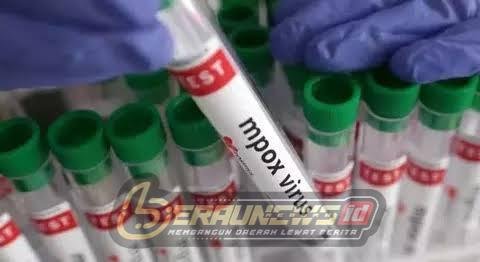 Seorang Warga Diduga Terjangkit Mpox, Dinkes Berau Bantah: Itu Cacar Air